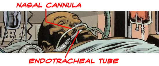 Wires And The Concept Of Breathing. tubes/wires going into his