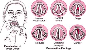 vocal cords